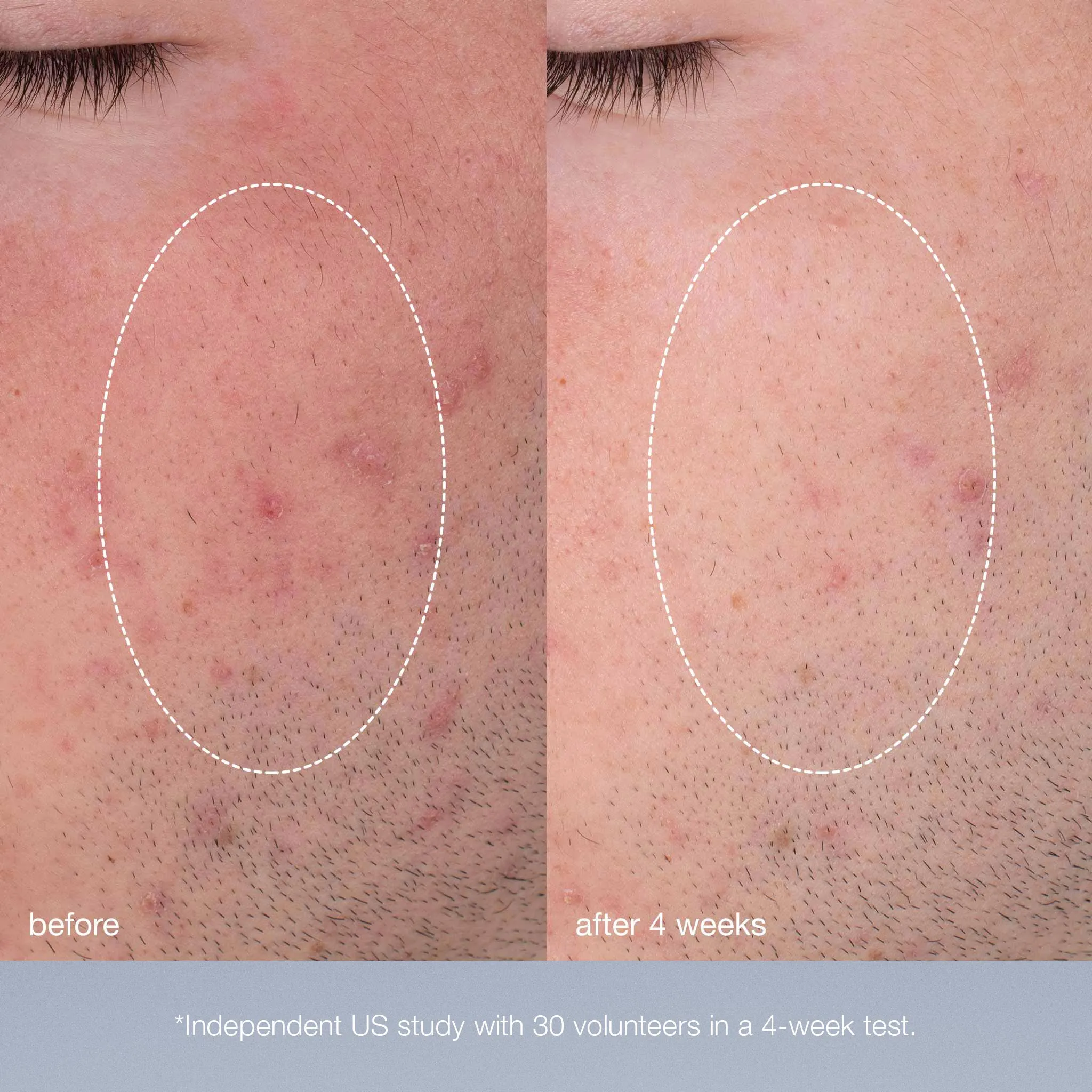 daily microfoliant exfoliator