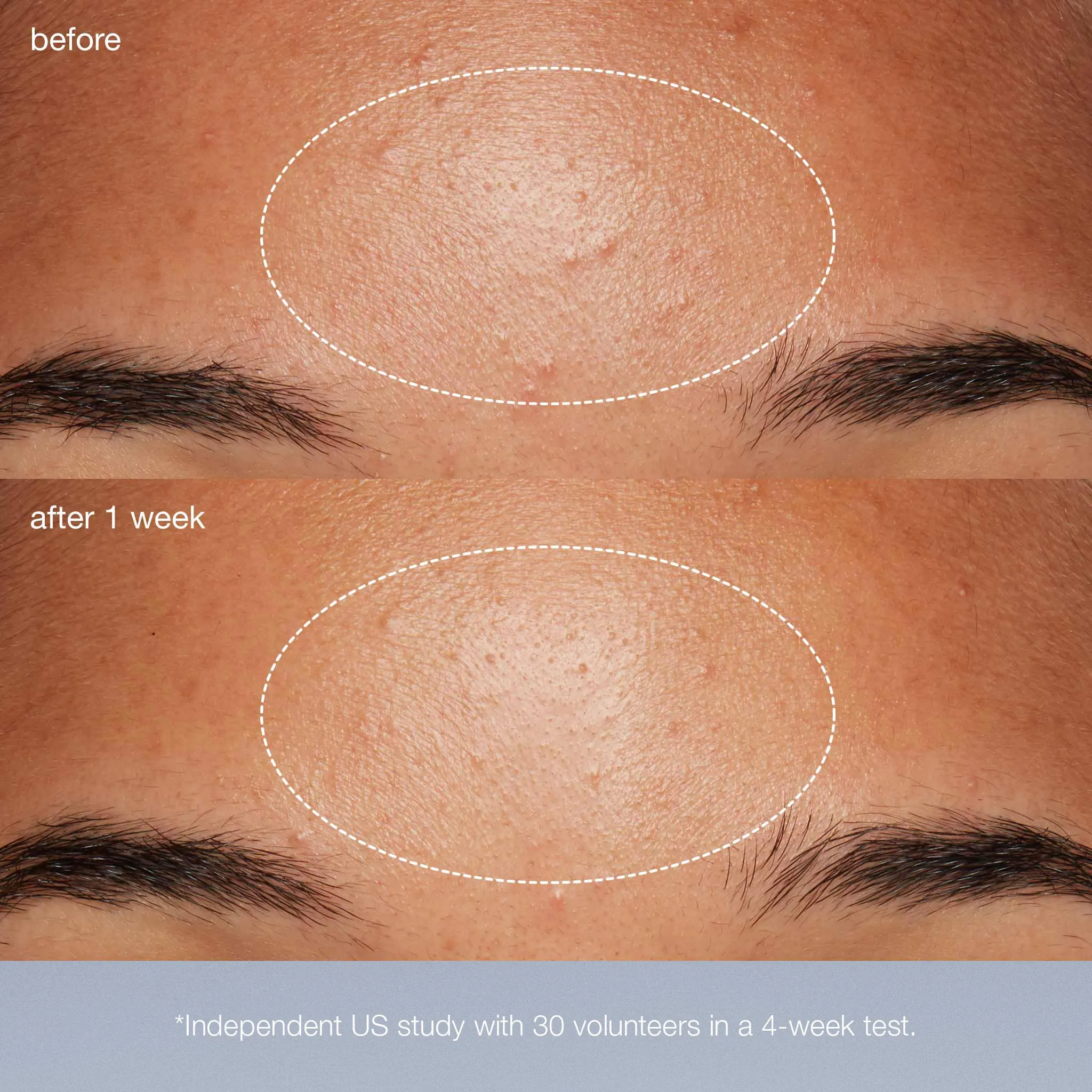 daily microfoliant exfoliator