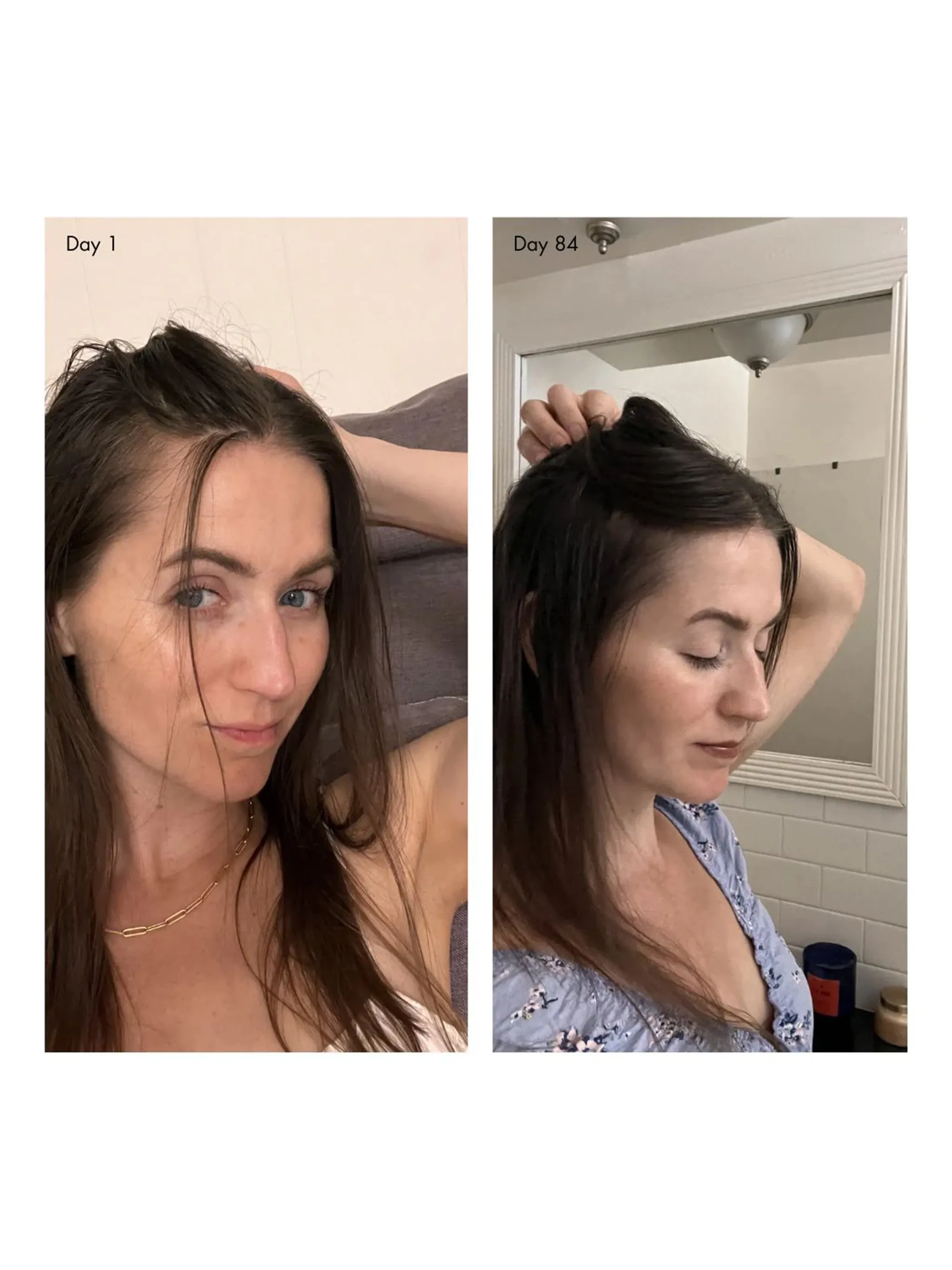 holi (growth) 84 advanced leave-in growth scalp treatment