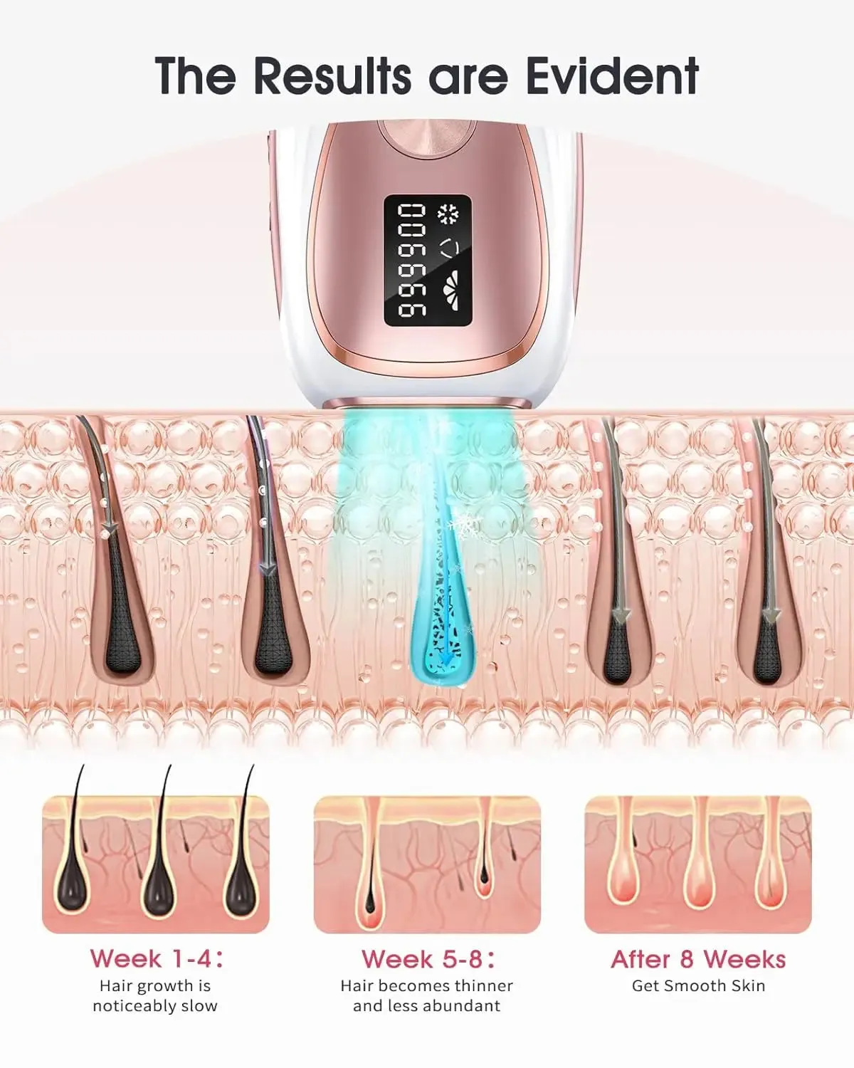 IPL Laser Hair Removal White Gold Epilator-5 Levels, 2 Modes 999900 Flashes